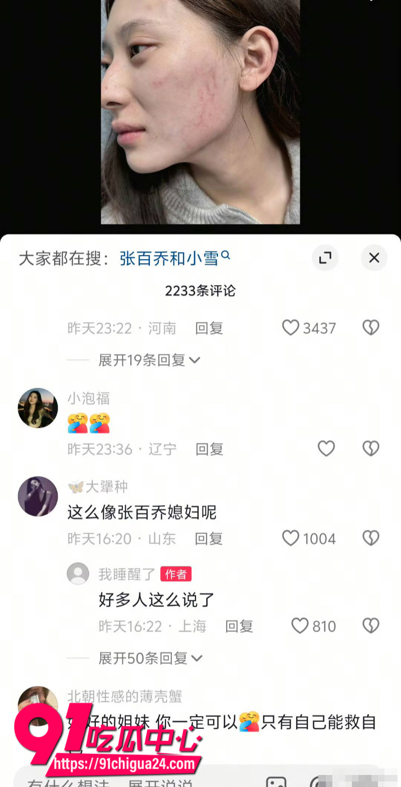 千万大V张百乔家暴老婆视频流出老婆迅速网上辟谣11 千万大V张百乔家暴老婆视频流出老婆迅速网上辟谣11