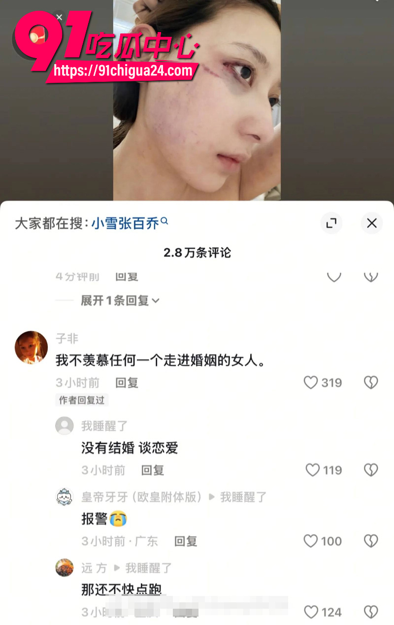 千万大V张百乔家暴老婆视频流出老婆迅速网上辟谣31 千万大V张百乔家暴老婆视频流出老婆迅速网上辟谣31
