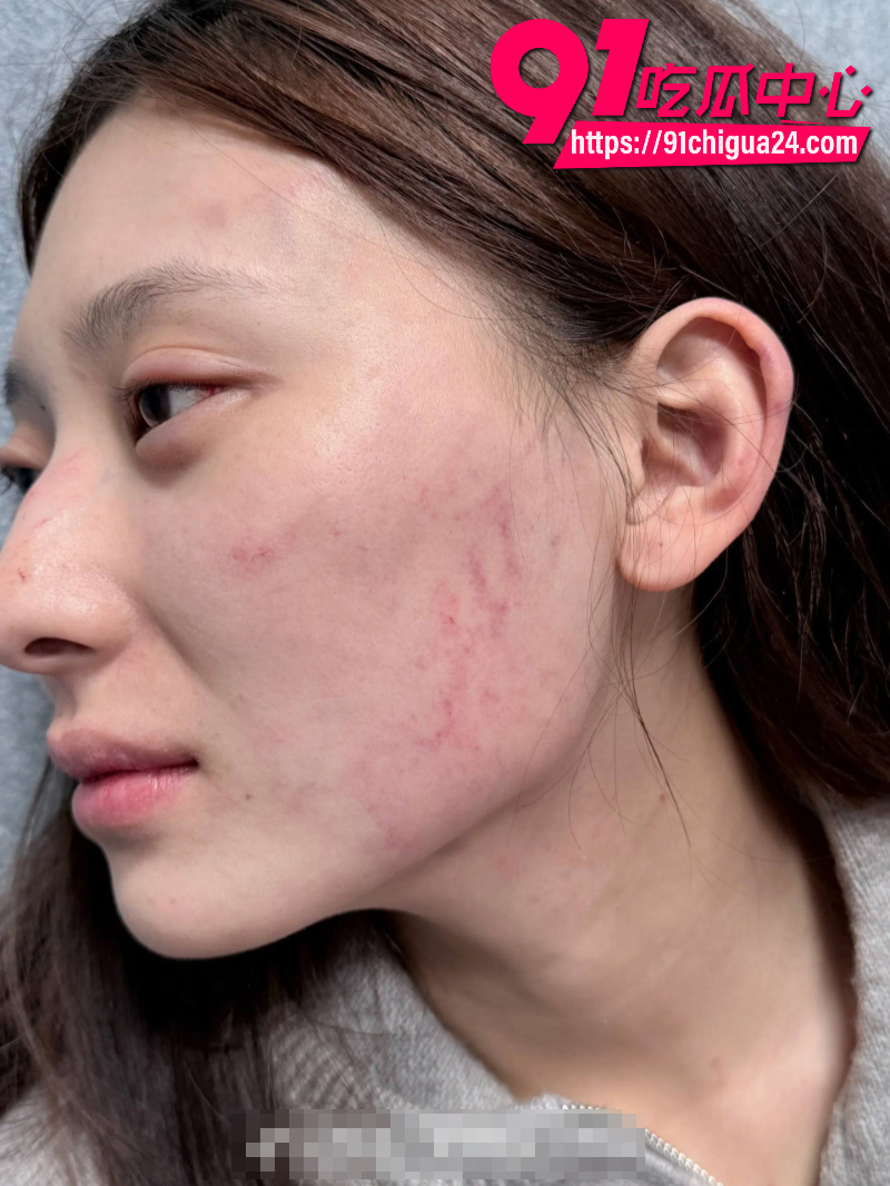 千万大V张百乔家暴老婆视频流出老婆迅速网上辟谣29 千万大V张百乔家暴老婆视频流出老婆迅速网上辟谣29