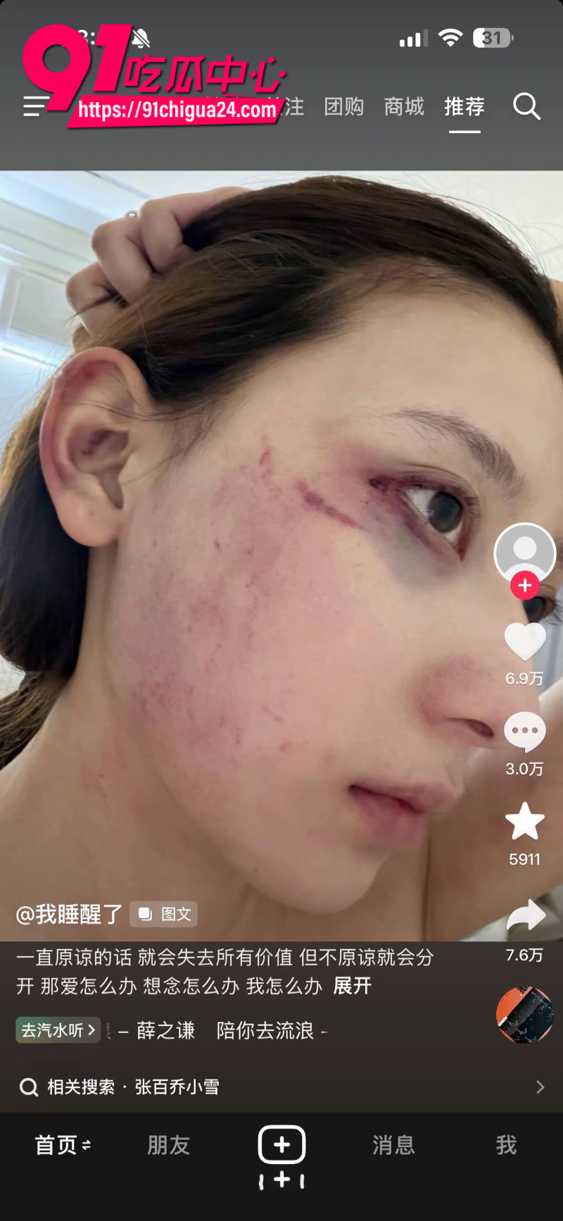 千万大V张百乔家暴老婆视频流出老婆迅速网上辟谣20 千万大V张百乔家暴老婆视频流出老婆迅速网上辟谣20