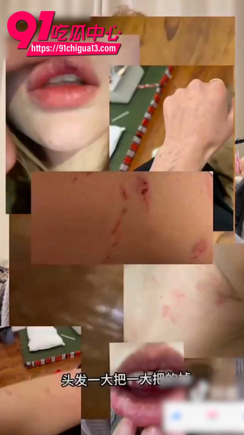 抖音女网红达哇措被好闺蜜找人暴打15 抖音女网红达哇措被好闺蜜找人暴打15
