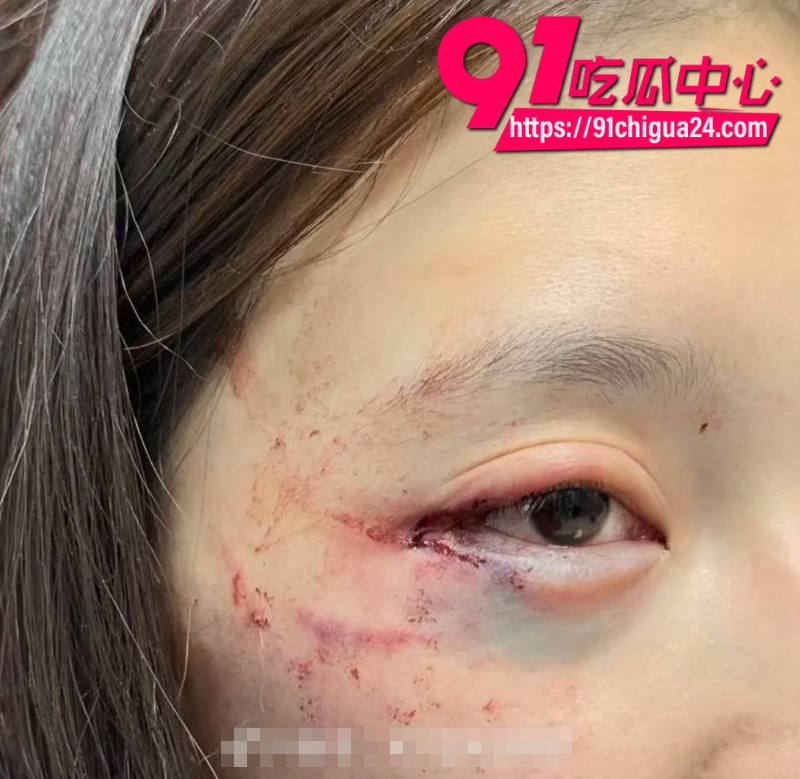 千万大V张百乔家暴老婆视频流出老婆迅速网上辟谣28 千万大V张百乔家暴老婆视频流出老婆迅速网上辟谣28