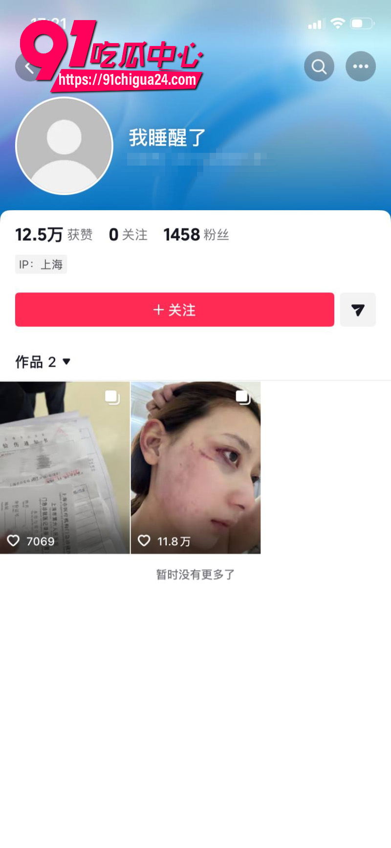 千万大V张百乔家暴老婆视频流出老婆迅速网上辟谣21 千万大V张百乔家暴老婆视频流出老婆迅速网上辟谣21