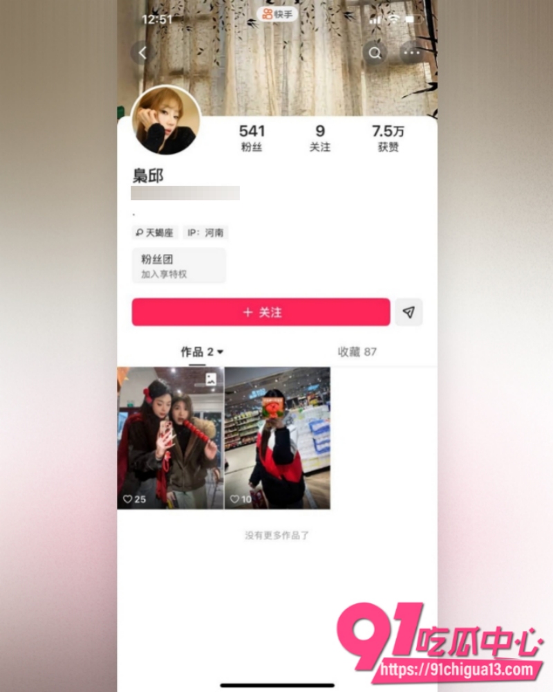 温州医科巴基斯坦留学生乐阳  20